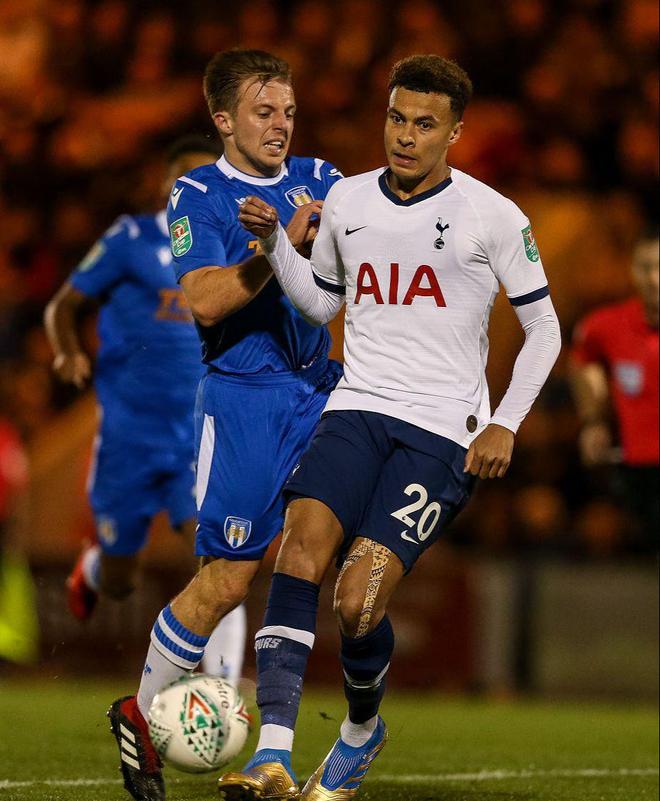 邮报：小将塞古-科内已经重返赛场，和多古用同一个私人教练（邮报：小将塞古-科内复出，与多古共用同一位私人教练）